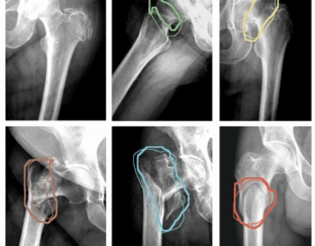 radiology_lesion_detection_and_classification