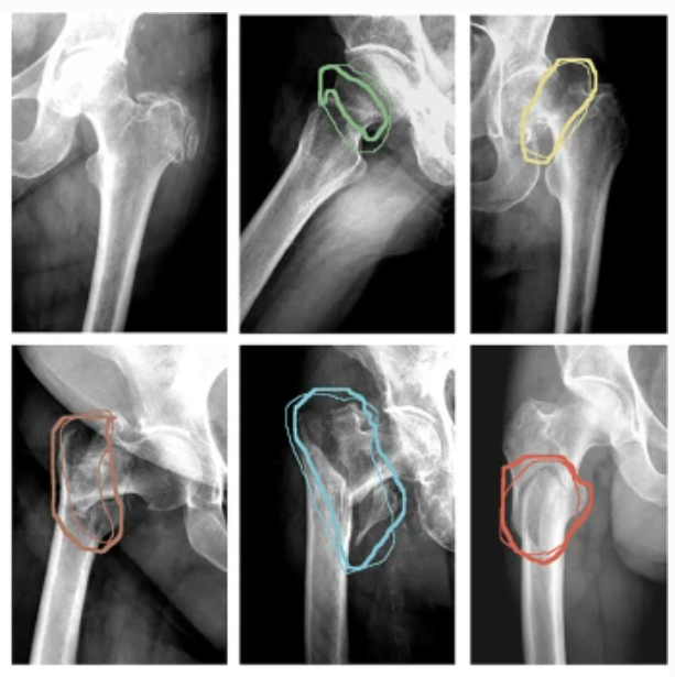 radiology_lesion_detection_and_classification
