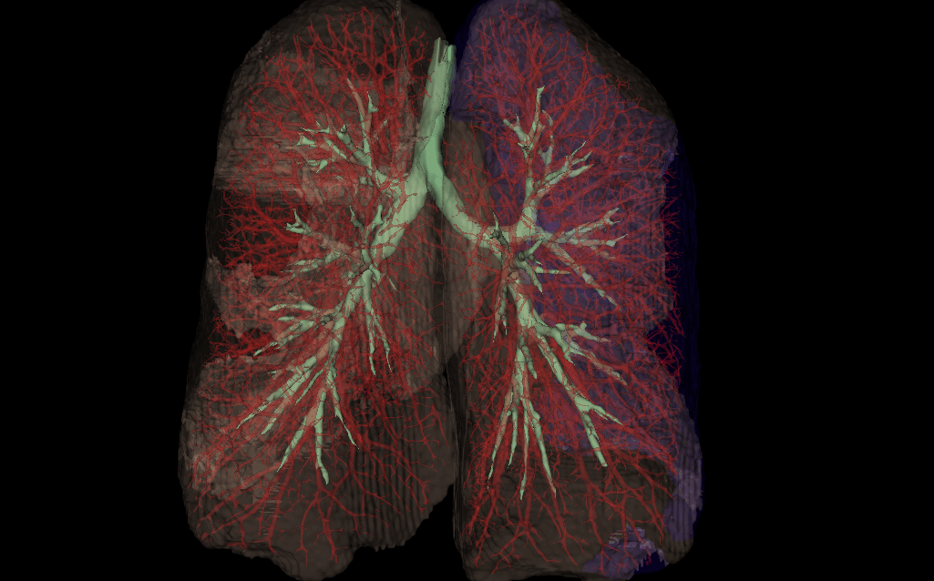 Lungs